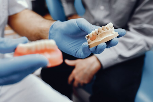 Types of Dental Implants Explained