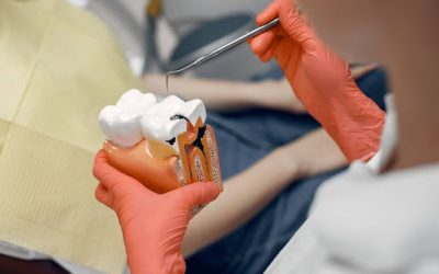 What Is a Root Canal and When Do You Need One?