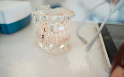 Dental Implants: Surgery, Benefits & Why You Need It