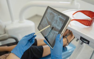 Root Canal Treatment FAQs in Navi Mumbai