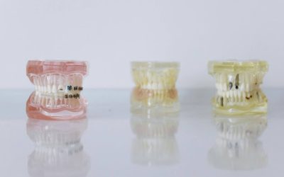 Smile Design: Types, Treatment & Costs Explained