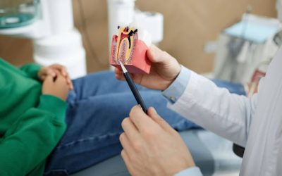 Benefits of a Single-Sitting Root Canal vs Traditional Multi-Visit Root Canal