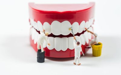 Dental Implants: Step-by-Step Procedure Explained