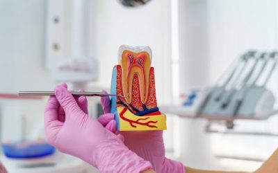 Common FAQs Related to Single-Sitting Root Canal