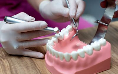 Full Mouth Dental Implants: Cost, Procedure & What to Expect