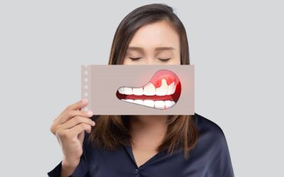 Gum Disease: Stages, Prevention & Treatment