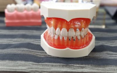 Top Benefits of Visiting a Specialized Dental Implant Clinic