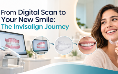 From Digital Scan to Your New Smile: The Invisalign Journey