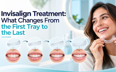 Invisalign Treatment: What Changes From the First Tray to the Last