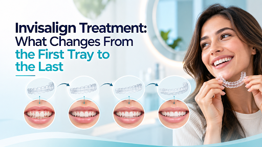 Invisalign treatment timeline Invisalign treatment timeline