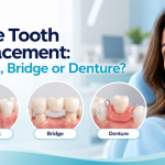 Single Tooth Replacement